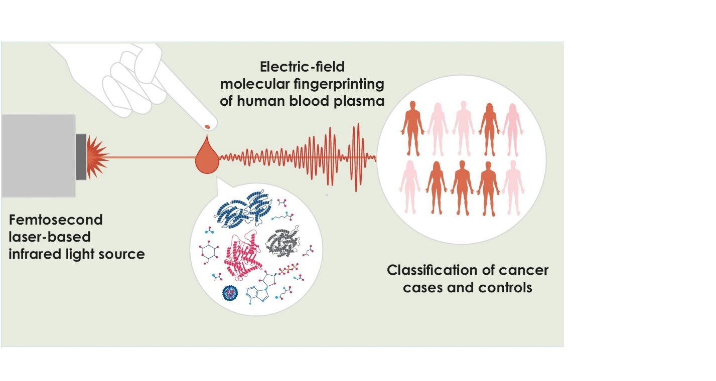 Schematic of Field Resolved Spectroscopy for cancer detection from blood plasma